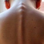 The mental spine straightening as an alternative healing method